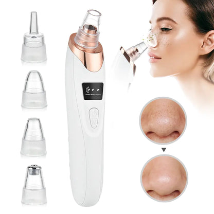 OMNI™ Electric Blackhead Remover