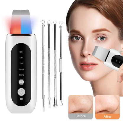 OMNI™ Ultrasonic Face Skin Scrubber